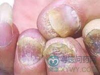 哪位高手能帮我解决一下玻璃纤维(玻璃丝)的碎