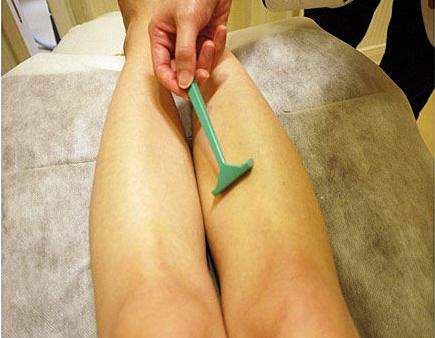 谁有普外科各种疾病的手术备皮范围图片-有姐