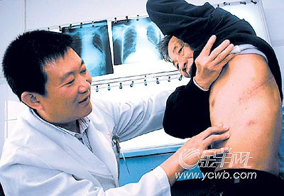 胸壁结核