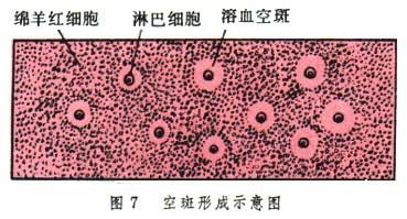 新型肠道病毒空斑实验在猴轮状病毒中的应用效果观察