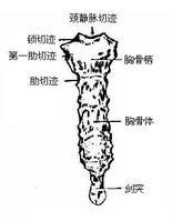 胸骨角