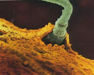 顶体反应+-+搜搜百科