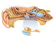 米尼尔氏综合症