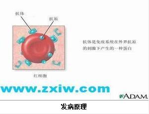 RH血型不合 - 搜搜百科