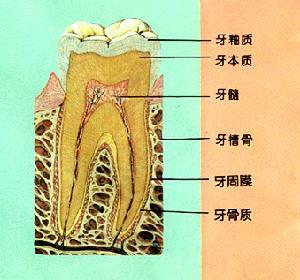 线形釉质龋齿