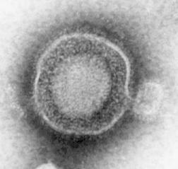 单纯疱疹病毒+-+搜搜百科