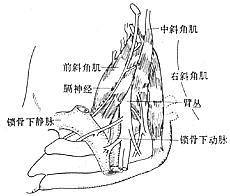 胸廓出口综合症