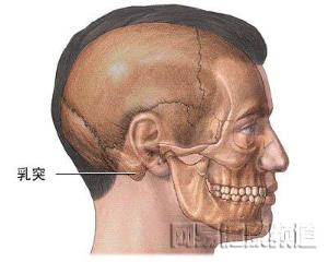 急性化脓性乳突炎