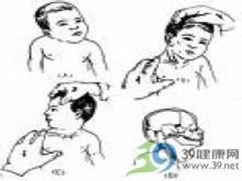 胸锁乳突肌图片