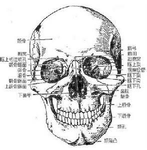 subdural hydroma,是因颅脑损伤时,脑组织在颅腔内强烈移动,致使蛛