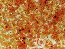 mg)可引起人类泌尿生殖系统感染