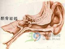 颞骨岩部炎