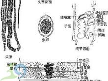      复孔绦虫病(dipylidiasis)是由犬复孔绦虫