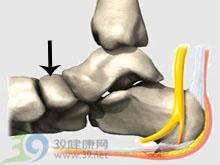 目录 目录 大事记 光影集锦 图册集锦 花絮视频 概述 足舟骨骨软骨