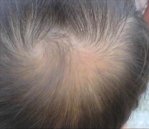 掉<em>头发</em>便宜价格 质量<em>好吗</em>