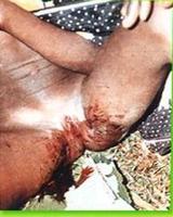 非洲女孩割礼- 搜搜百科