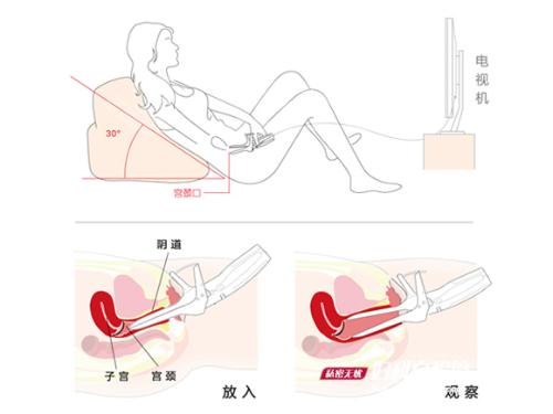 减免女性妇科检查心理压力