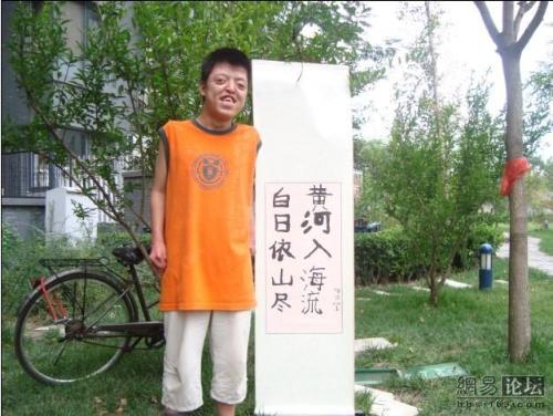 先天性<em>甲状腺功能低下</em>症