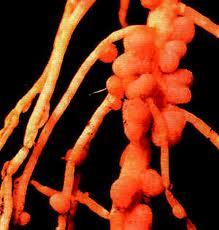 根瘤 - 搜搜百科