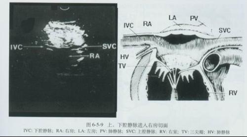 m型超声心动图 - 搜狗百科