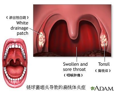 咽喉图片结构图