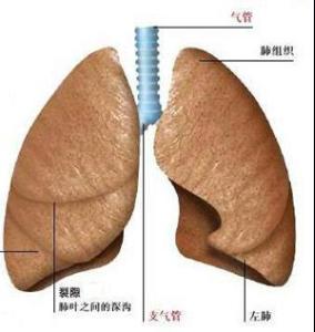 尘肺病