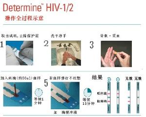 HIV试纸