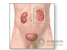 【高清】肾痛是什么原因\/肾疼一般是什么病