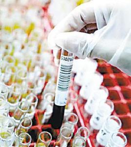 乙肝DCI细胞免疫诱导疗法