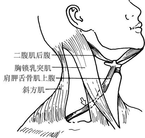 在胸骨舌骨肌的外侧,为细长带状肌,分为上腹,下腹,由位于胸锁乳突肌