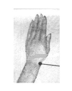 取穴方法:阳溪穴位于人体的腕背横纹桡侧,手拇指向上翘时,当拇短伸