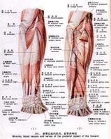 左小腿骨筋膜室综合征