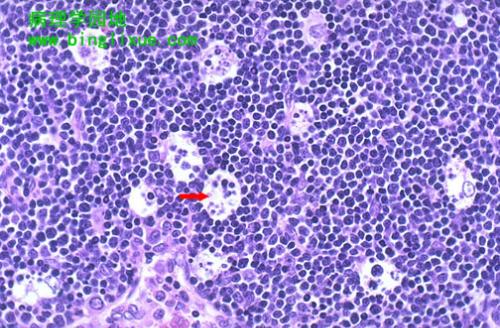 T淋巴细胞-+搜搜百科