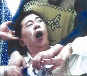 癫痫大发作+-+搜搜百科