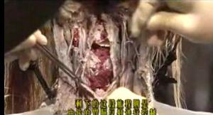位置和构造(八个系统:生殖