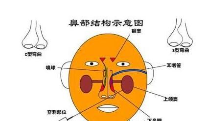 鼻塞的原理图_鼻塞的原理是什么(2)