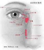 全部版本 最新版本  定义 用途   探讨鼻内窥镜下鼻泪管,泪道逆行插管