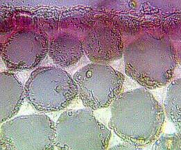 厚角细胞