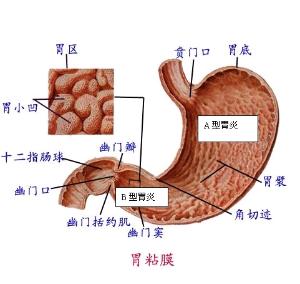 慢性<em>糜烂性胃炎</em> - 搜搜百科