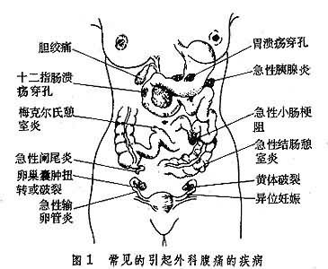 腹疼-+搜搜百科