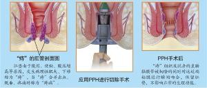 <em>肛门瘙痒</em> - 搜搜百科
