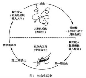 班氏丝虫