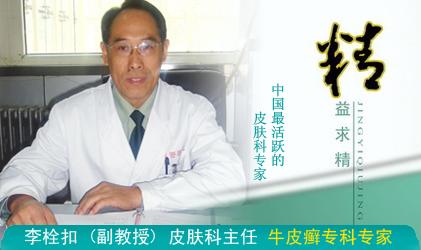 武警河北总队医院牛皮癣专家李栓扣