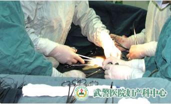 卵巢囊肿的治疗方法