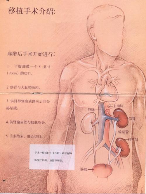 此外还有外伤所致双肾或孤立肾丧失者