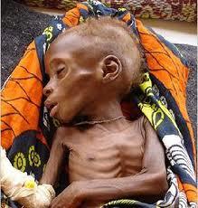 查看详细百科 (图)饥饿儿童; 饥饿儿童_图片_互动百科; 非洲饥饿儿童