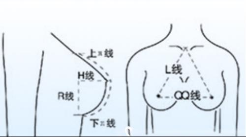 乳房整形要通过手术尽力塑造出半球形