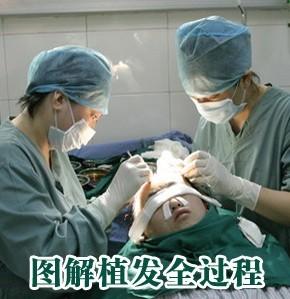 心自主研发的<em>头发加密技术</em>