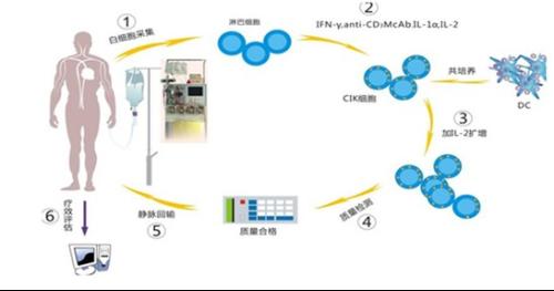 生物细胞股动脉介入疗法步骤