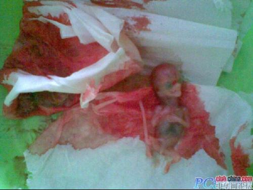 堕胎门+-+搜搜百科